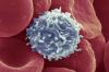 Wetenschappers hebben een manier gevonden, waardoor de T-cellen om te beginnen om kanker te bestrijden