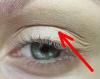 Hoe zich te ontdoen van hangende oogleden zonder kunststoffen