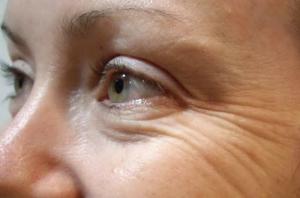 Hoe om het uiterlijk van rimpels rond de ogen te voorkomen
