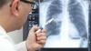 Arts vergelijkt stralingsblootstelling met CT van longen met straling in Hiroshima