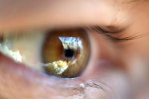 Netvliesloslating ogen: hoe het gezichtsvermogen te redden?