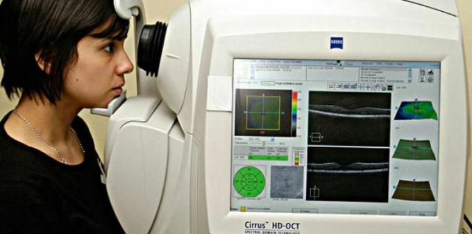 Optische coherentie tomografie angiografie