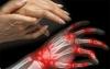 Symptomen en oorzaken van reumatoïde arthritis waarschuwen