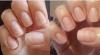 Hoe om te herstellen na de bouw van de nagels en het versterken van de nagelplaat