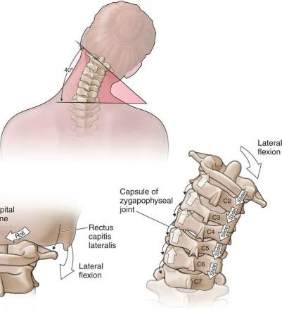 4 basisoefeningen voor de cervicale wervelkolom helpen u pijn en osteochondrose te vergeten!