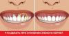 Hoe kan het tandvlees te behandelen wanneer de tanden worden blote nek?
