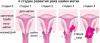 7 tekenen van baarmoederhalskanker, waarin vrouwen vaak negeren