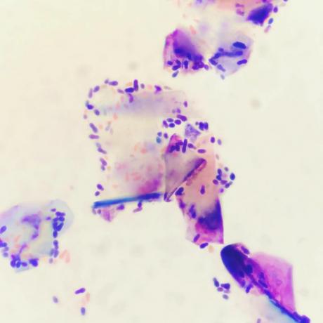 De schimmel Malassezia. vele variëteiten van dermatitis die ermee verbonden zijn. Maar dat is een apart onderwerp van gesprek