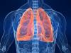 Rokers: hoe de bronchiën schoon te maken, longen?